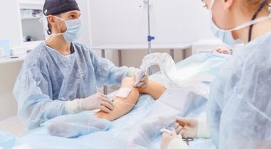 Fonctionnement des varices