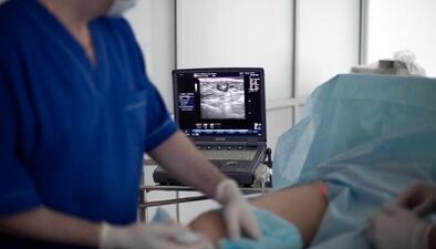 Traitement chirurgical des varices